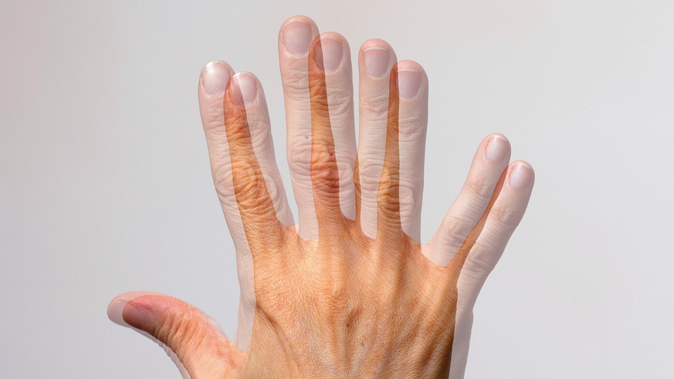 Visão dupla (diplopia)